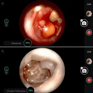 Artificial Intelligence in Otolaryngology