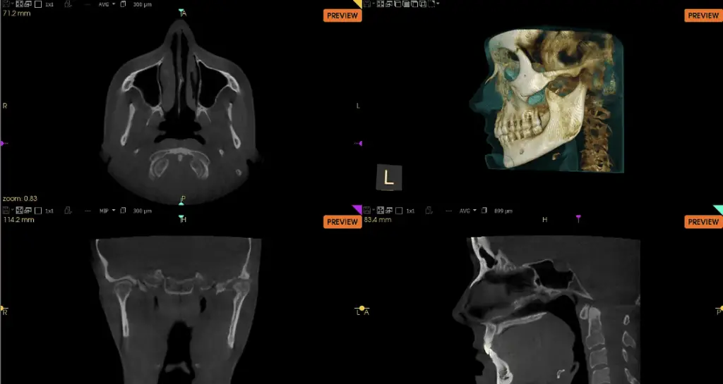 Dental - 3D Imaging